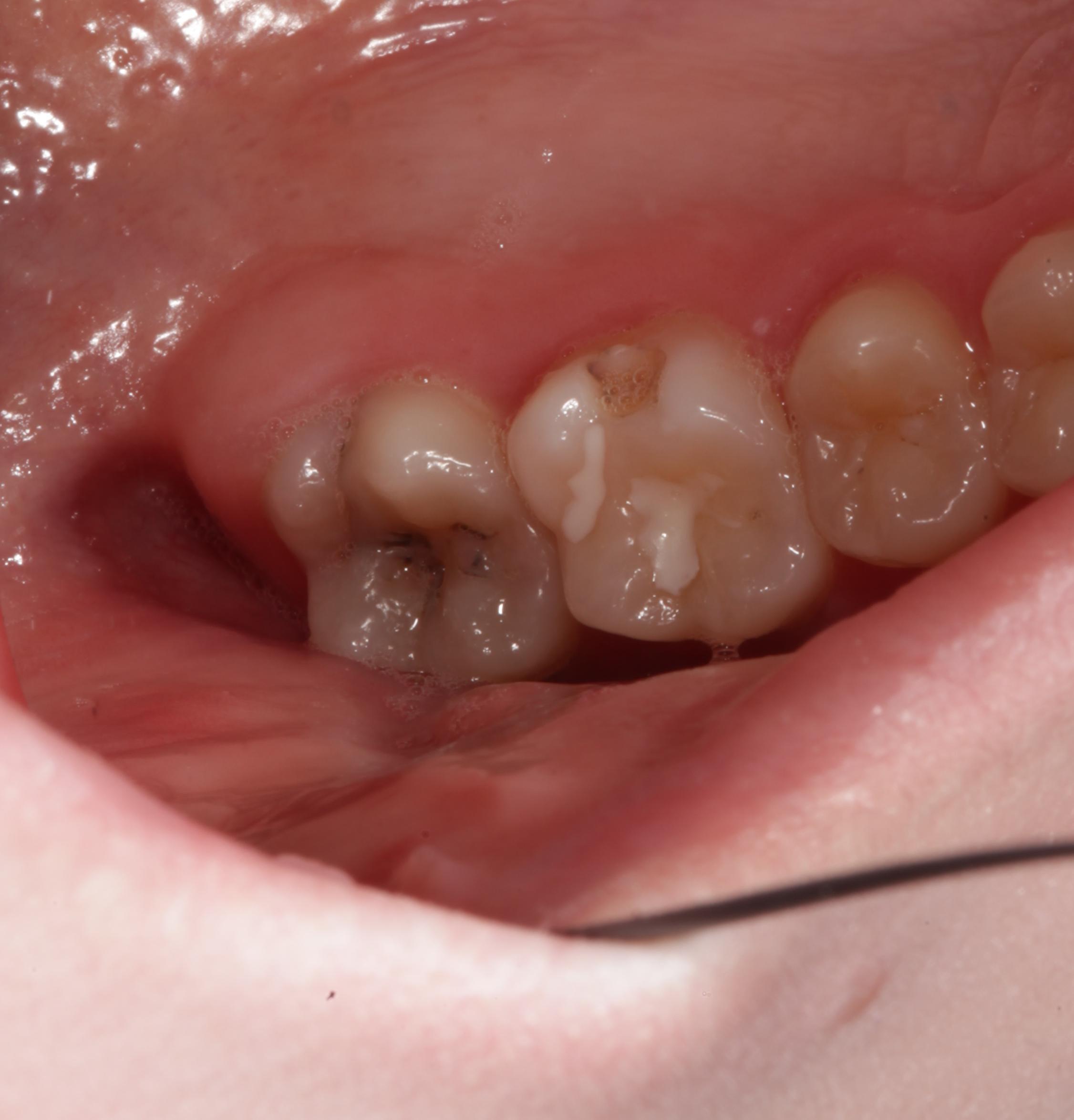 фото