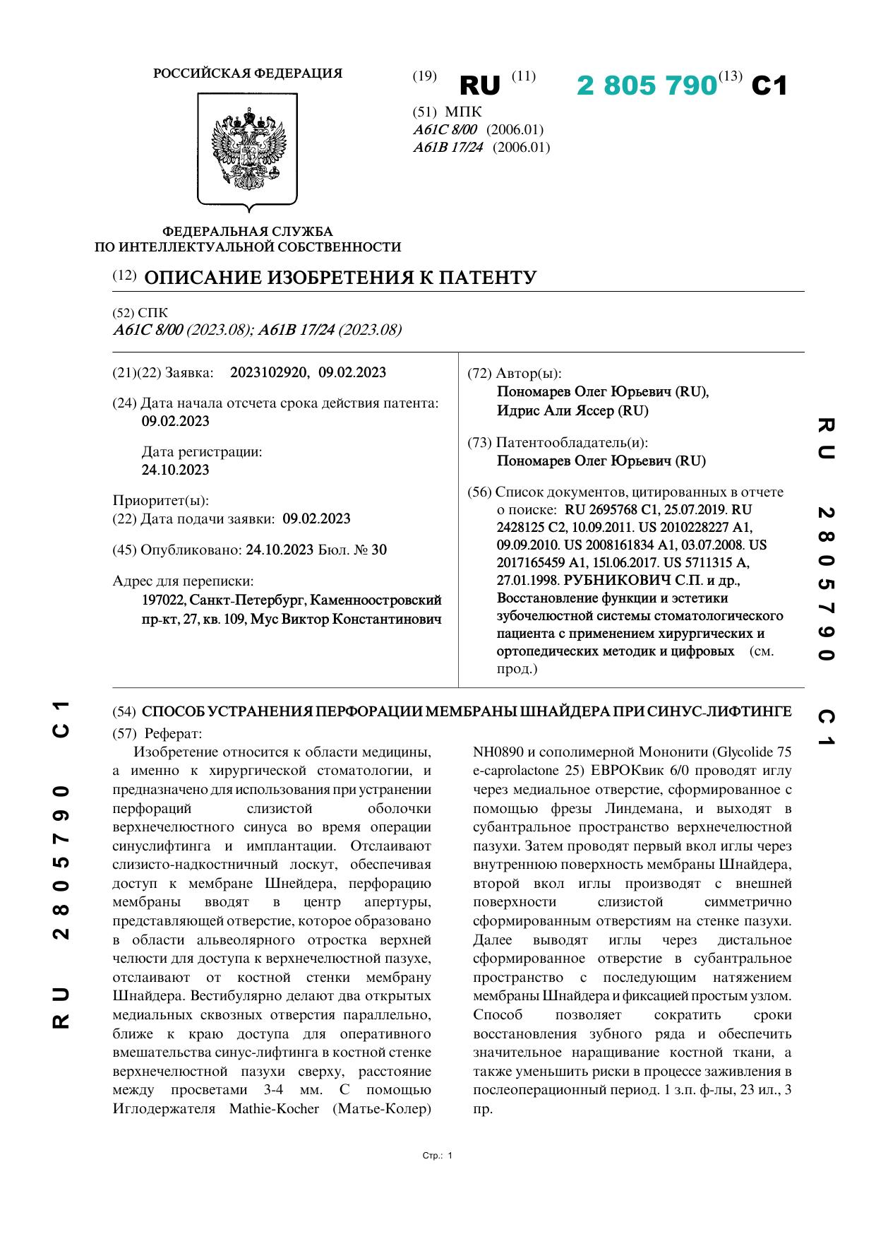 Патент №А61С 8/00 (2023.08); А61В 17/24 (2023.08) от 09.02.2023 Способ устранения перфорации мембраны Шнайдера при синус-лифтинге
