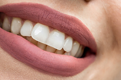 Стоматологи рассказали о вреде некоторых отбеливающих зубных паст