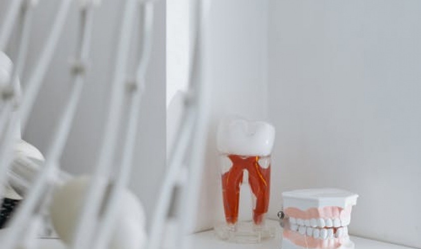 Когда можно ставить имплант после удаления зуба, и в какое время года лучше проводить протезирование