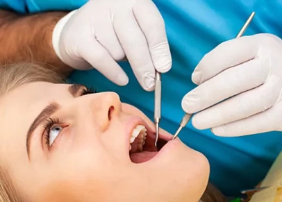 Стоматолог рассказал о главных минусах пирсинга во рту